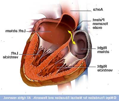 Ευρεσιτεχνίας ωοειδούς τρήματος. Φυσιολογική λειτουργία της καρδιάς.