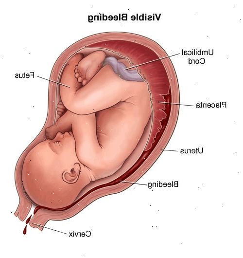 Αιμορραγία κατά τη διάρκεια της εγκυμοσύνης. Εμφύτευση αιμορραγία: κανονικά στην αρχή της εγκυμοσύνης;