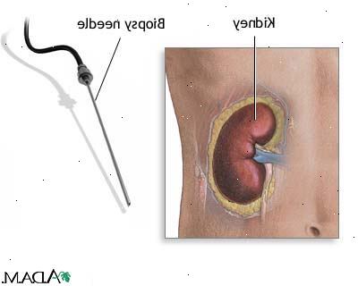 Δείγματα αίματος και ούρων. Άλλες διαδικασίες βιοψία νεφρού.