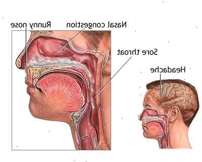 Κοινό κρυολόγημα. Οξεία λοίμωξη του αυτιού (μέση ωτίτιδα).